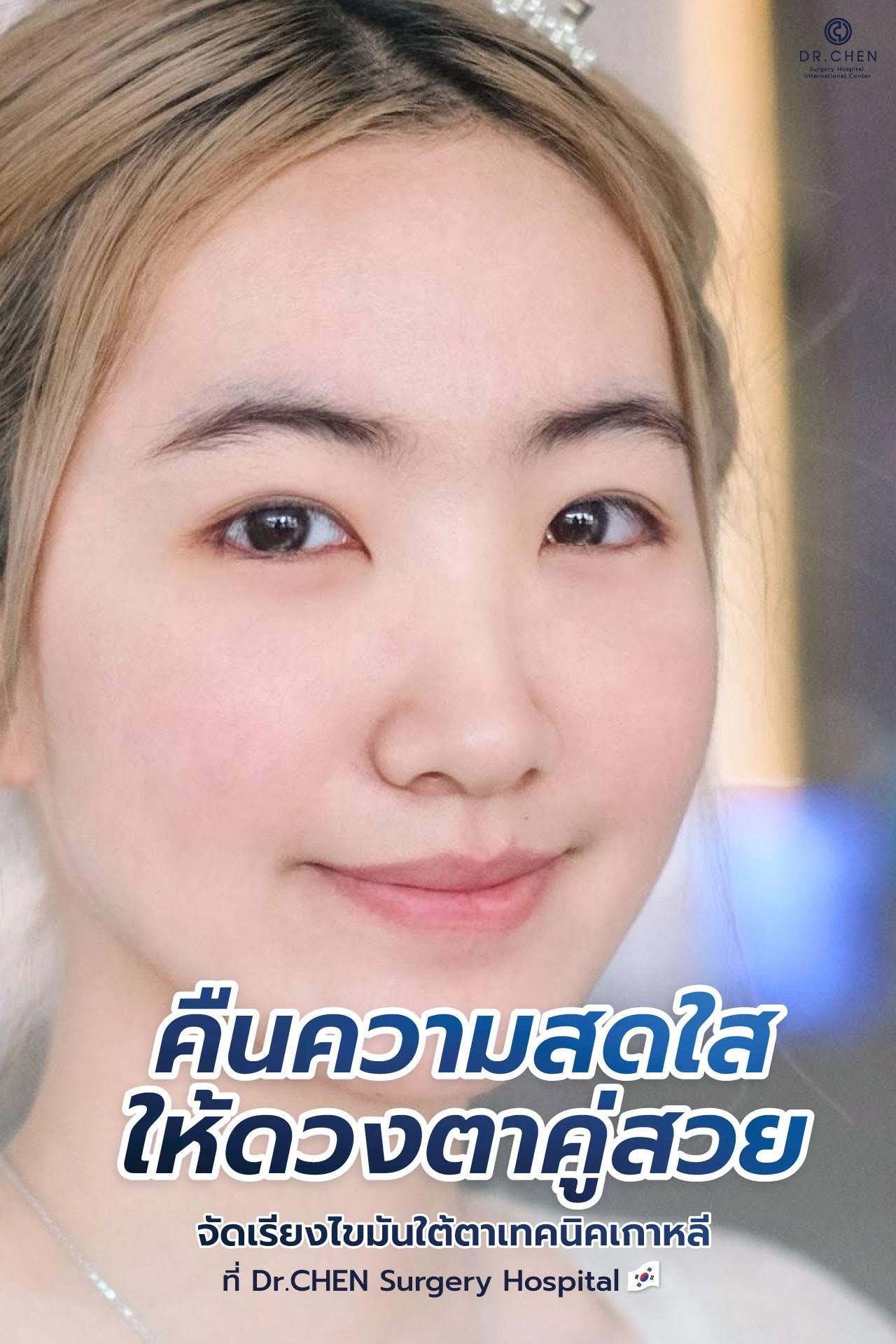 DRC Lower Blepharoplasty technique at DCH Hospital