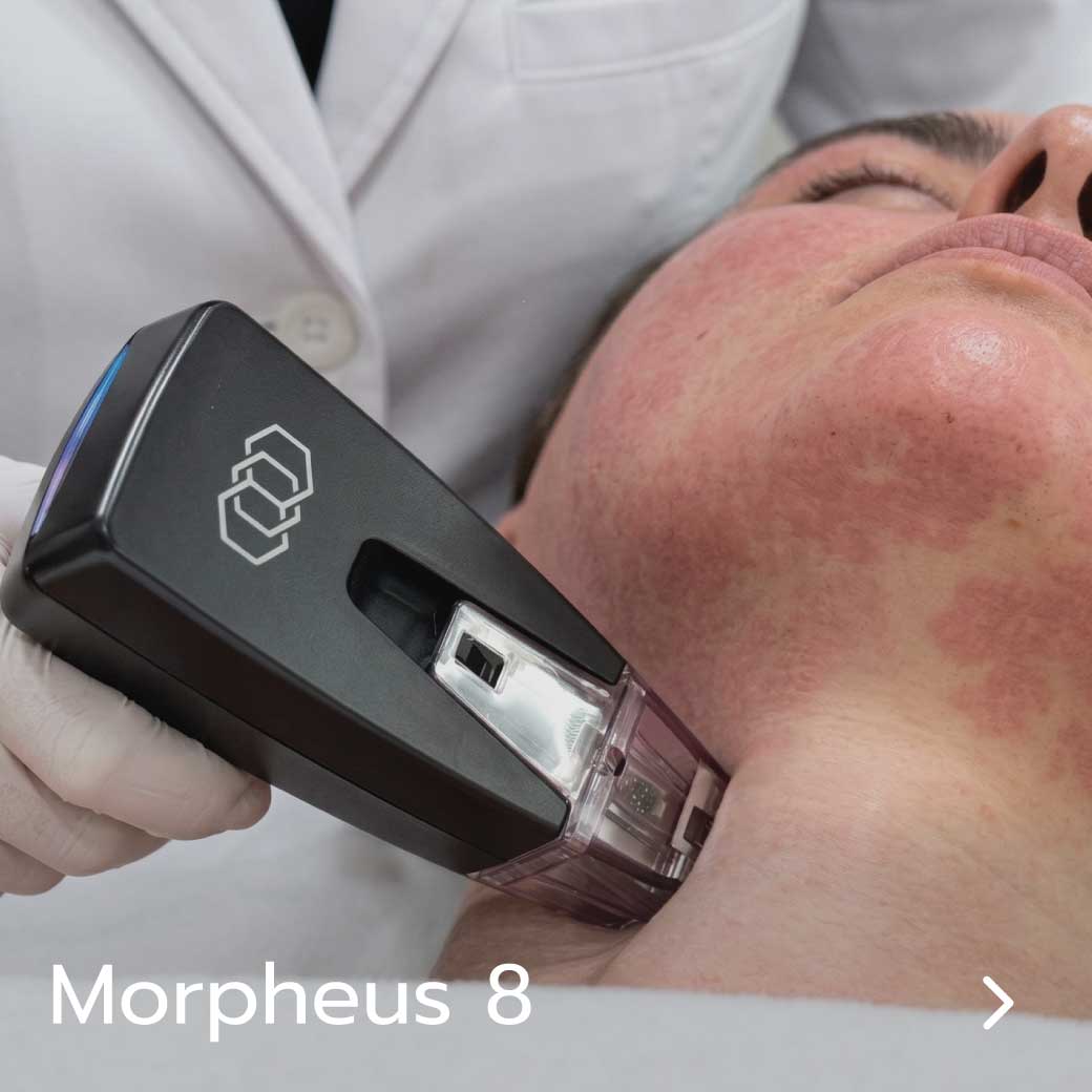 Morpheus-8