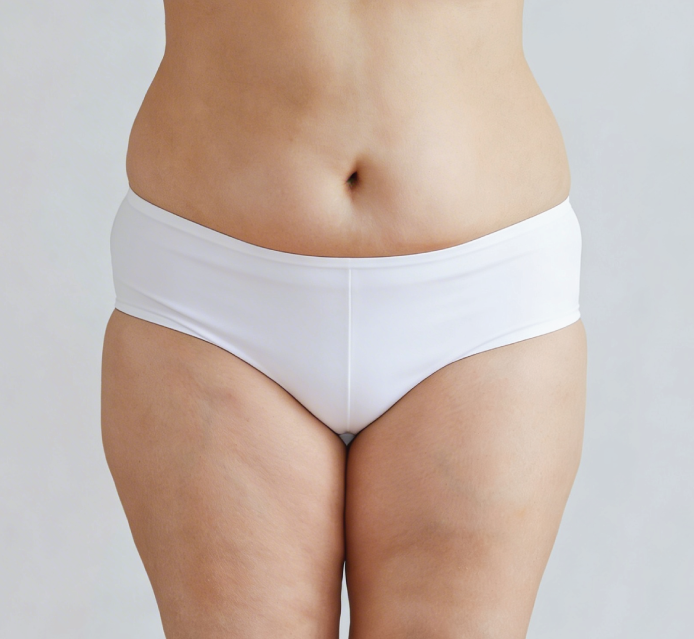 liposuction