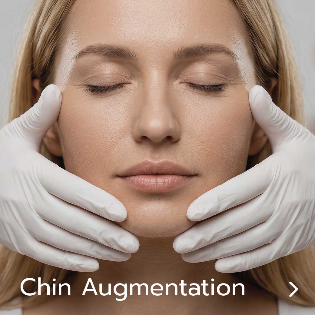 Chin Augmentation