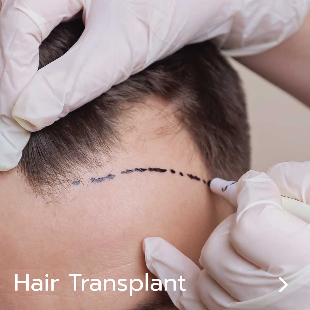 hair transplant bangkok