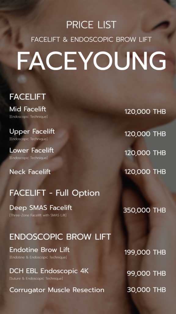 Facelift