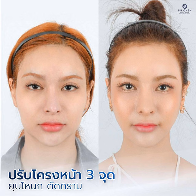 Contouring review 1