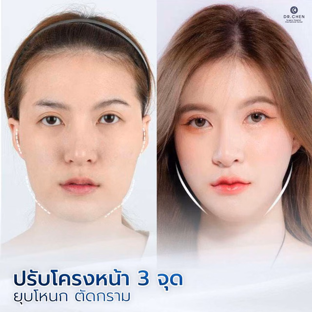 Contouring review 3