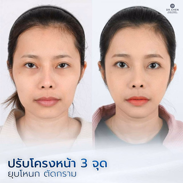 Contouring review 2