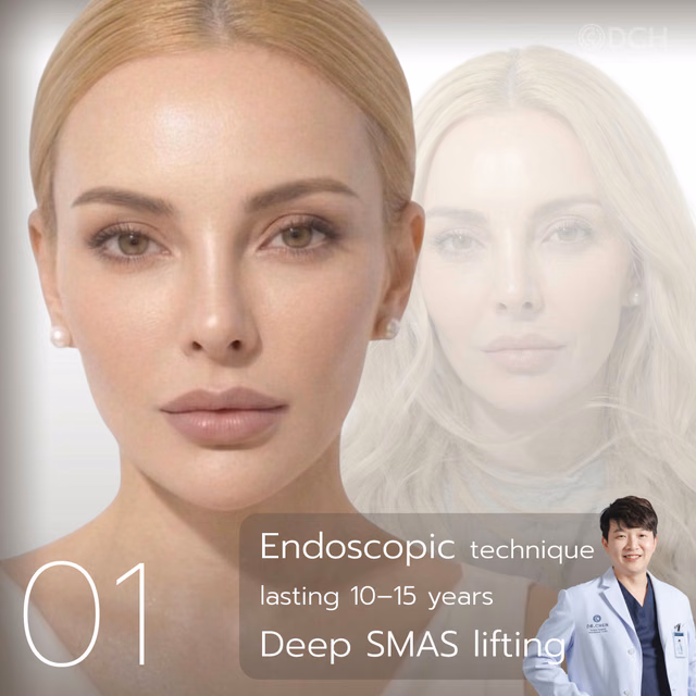 Step 1 · Deep SMAS Facelift