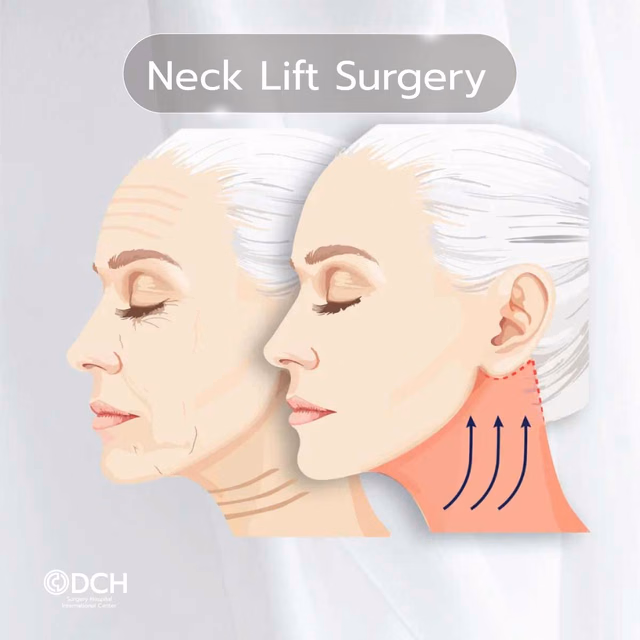 Technique 3 · Neck Lift Surgery