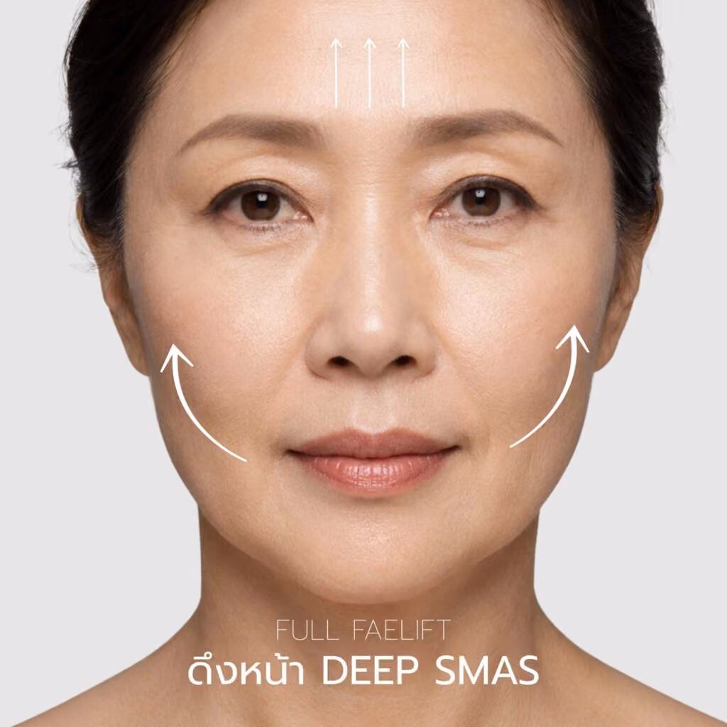 ภาพอธิบายการวางแผนศัลยกรรมดึงหน้าเต็มใบหน้า