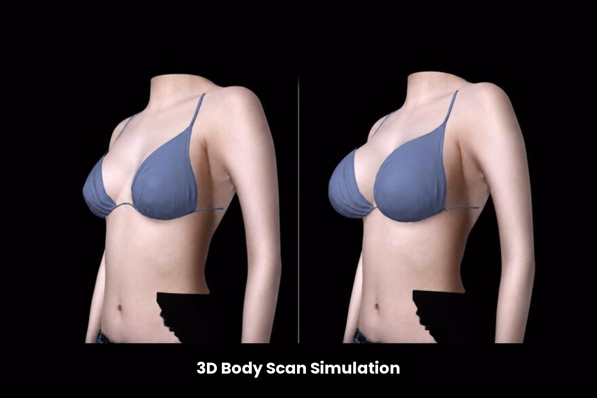 DCH Three-Dimensional Breast Planning Simulation
