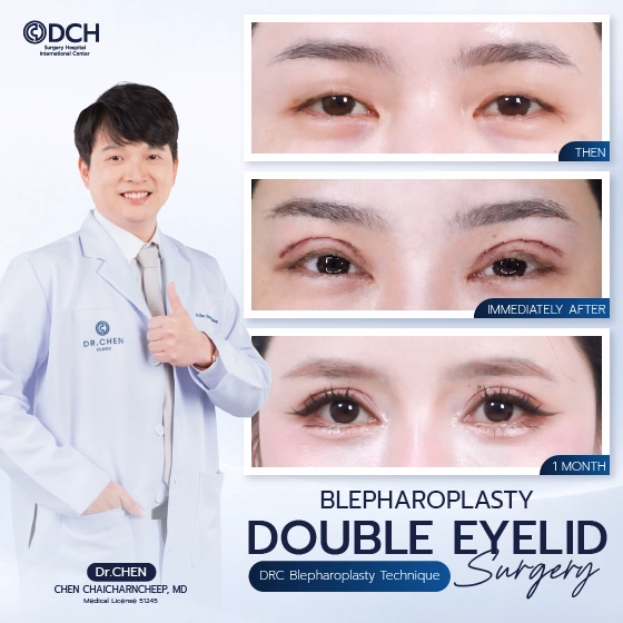 DCH Approved Eyelid Surgery Healing Stages
